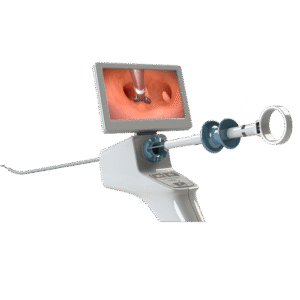 Histeroscopio OperaScope